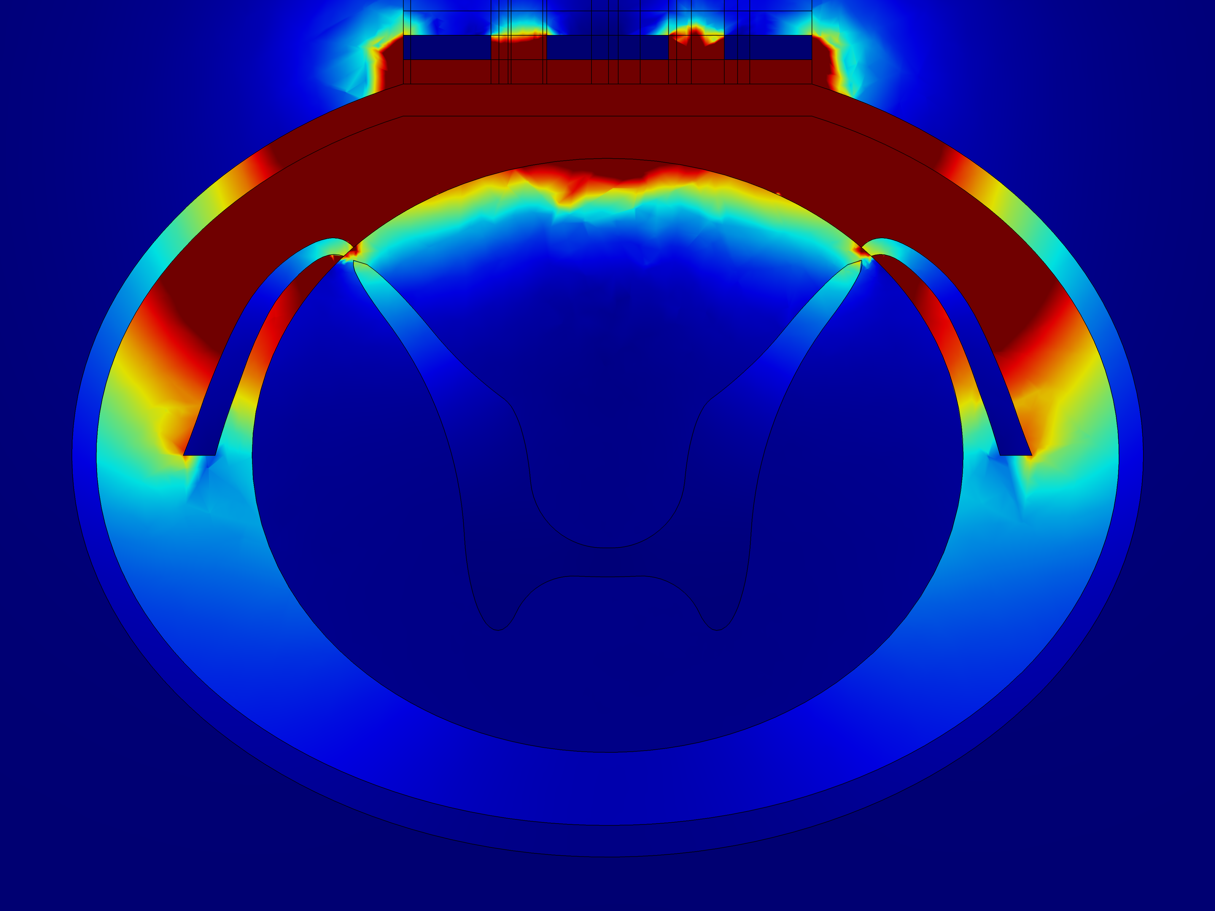 Control slice current density norm xz view What is the Nature of Pain?